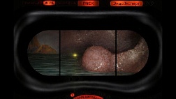 Пропуск аденом при колоноскопии (Adenoma miss rate, AMR)